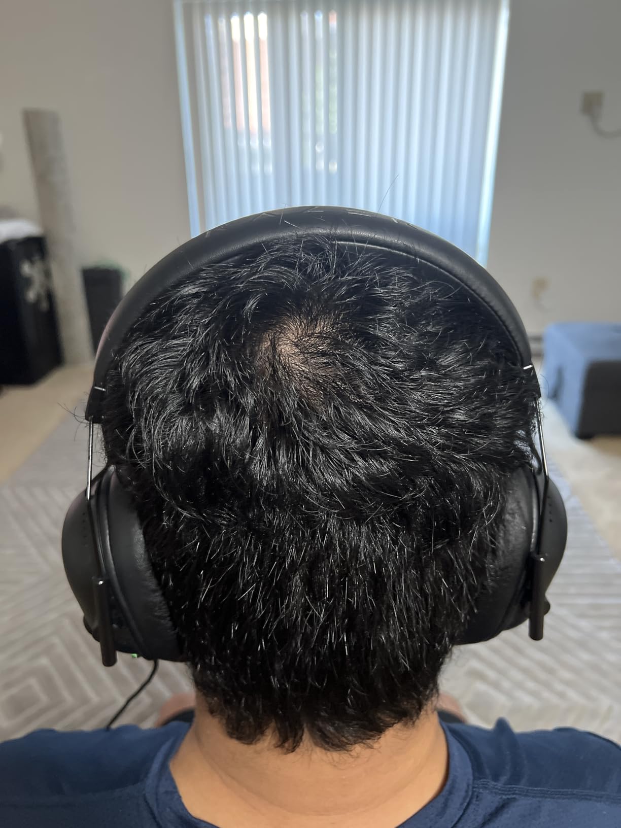 Razer BlackShark V2 X Gaming Headset: 7.1 Surround Sound - 50mm Drivers - Memory Foam Cushion - For PC, PS4, PS5, Switch - 3.5mm Audio Jack - Black - Customer Photo 1