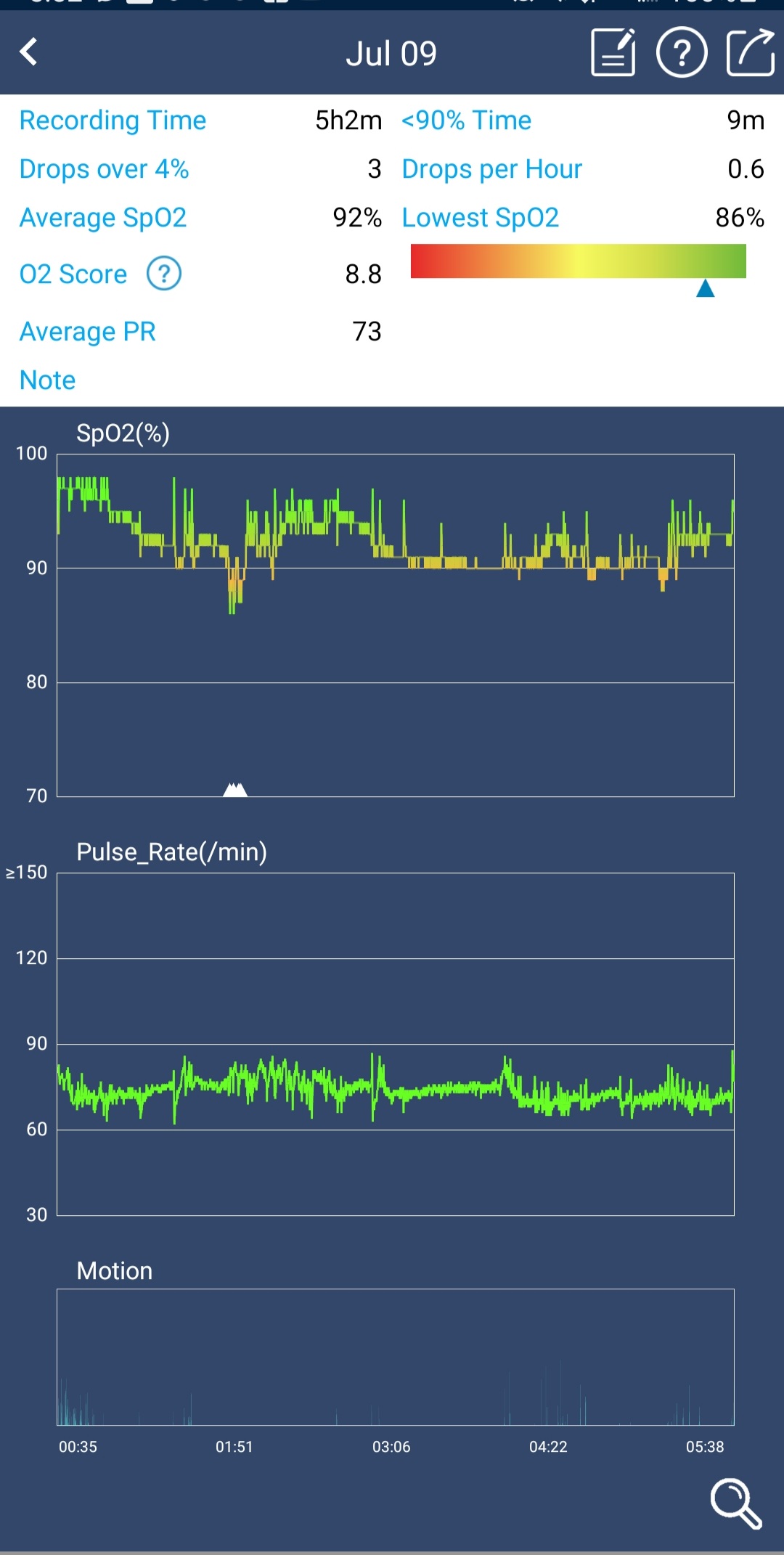 Wellue O2Ring Pulse Oximter, Bluetooth SPO2 Blood Oxygen Saturation Monitor - Wearable O2 Ring Sensor with Vibration Reminder, Free APP & PC Report, Rechargeable customer photo 1