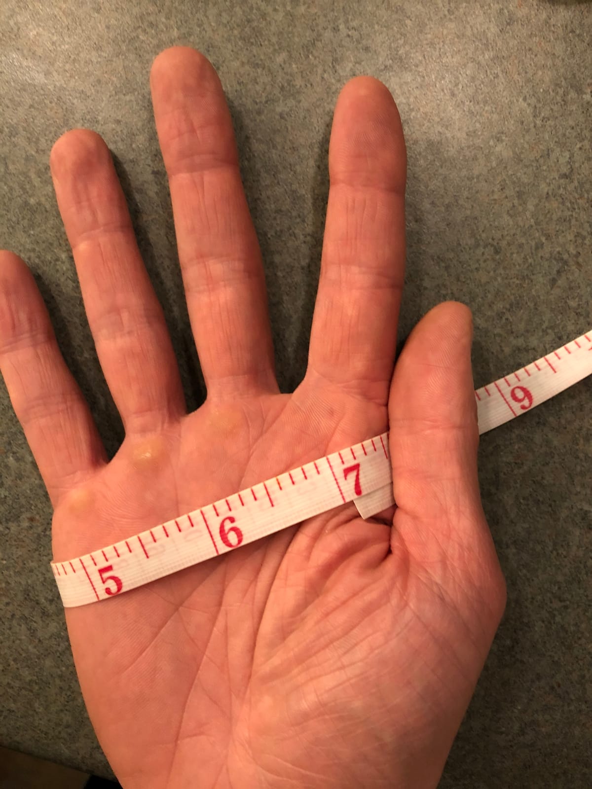 Triple Eight WRISTSAVER II Wrist Guards - Ideal for Skateboarding, in-line Skating, and Roller Skating customer photo 1
