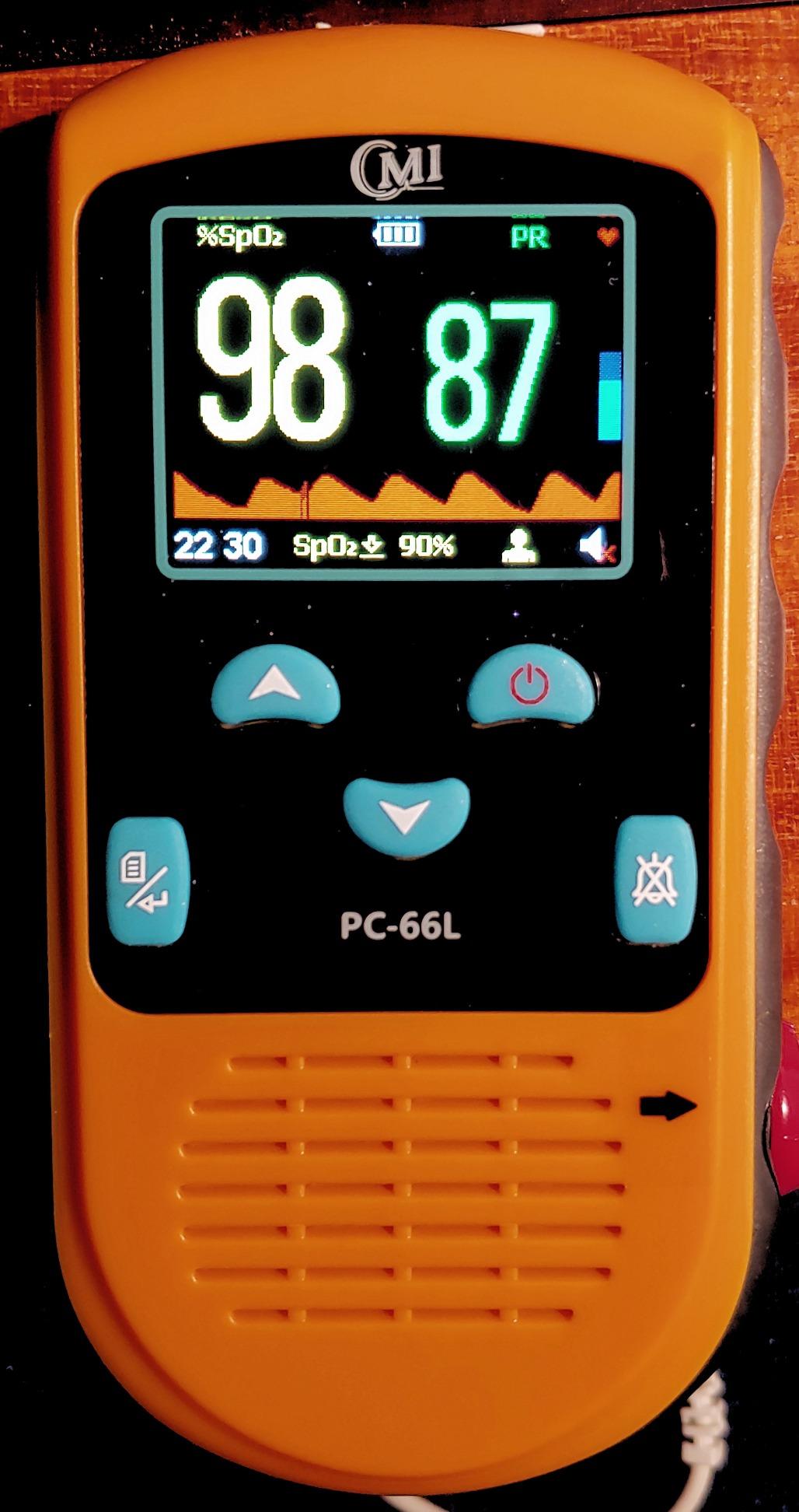 CMI Health Rechargeable Finger Pulse Oximeter for Adults, Continuous SpO2 & Pulse Rate Readings, Spot Check Mode, Adjustable Alerts, Ideal for Sports, Aviation & Wellness, Carry Case and AC Adapter Included customer photo 1
