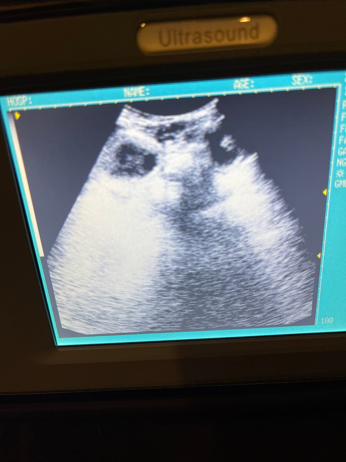 Ultrasound Scanner Veterinary V16 with 3.5 MHz Convex Probe for Pregnancy Test on Dogs, Sheep and Pigs customer photo 1