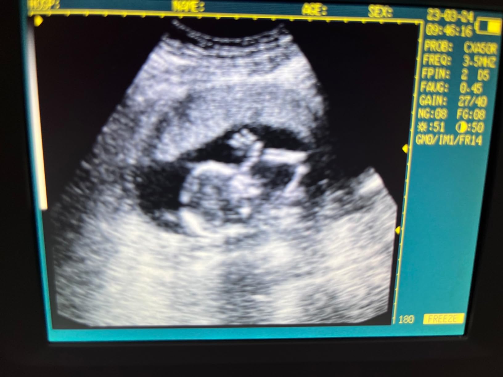 Ultrasound Scanner Veterinary V16 with 3.5 MHz Convex Probe for Pregnancy Test on Dogs, Sheep and Pigs customer photo 2